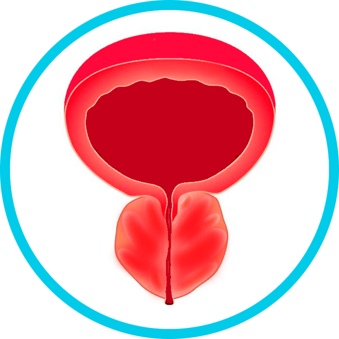 Síntomas de prostatitis